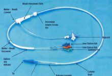 Ensemble Delivery System Components